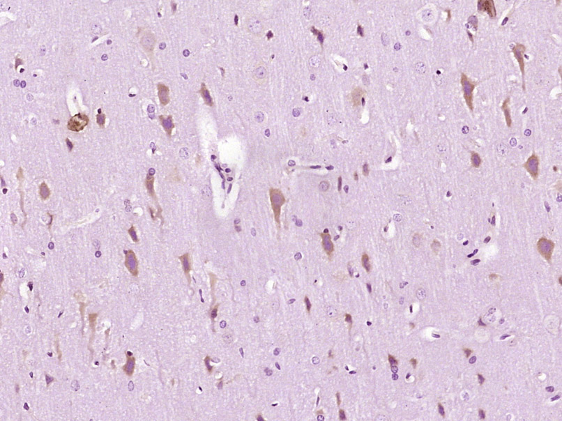 IRE1 Rabbit pAb (一抗) - IHC-P,IHC-F,IF | Bioss