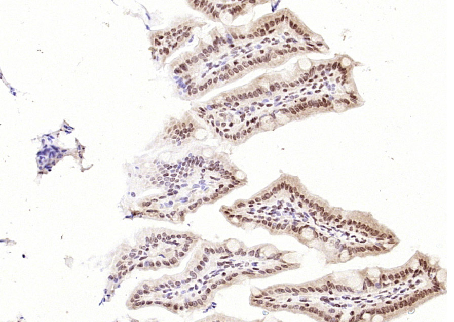 细胞肿瘤抗原P53抗体-bs-8687R
