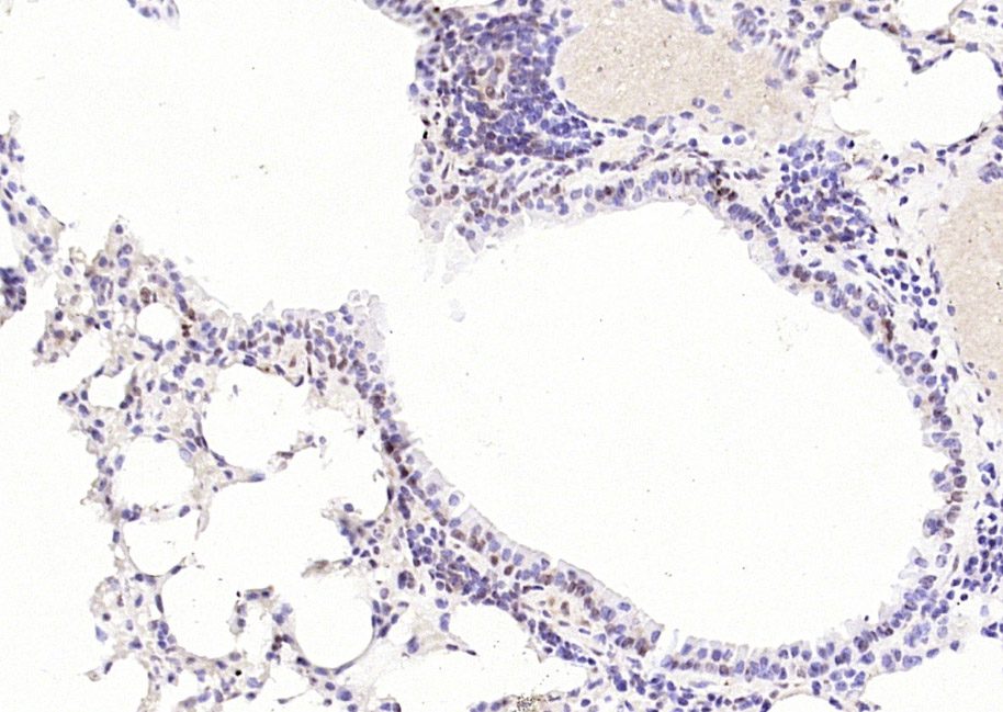 细胞肿瘤抗原P53抗体-bs-8687R