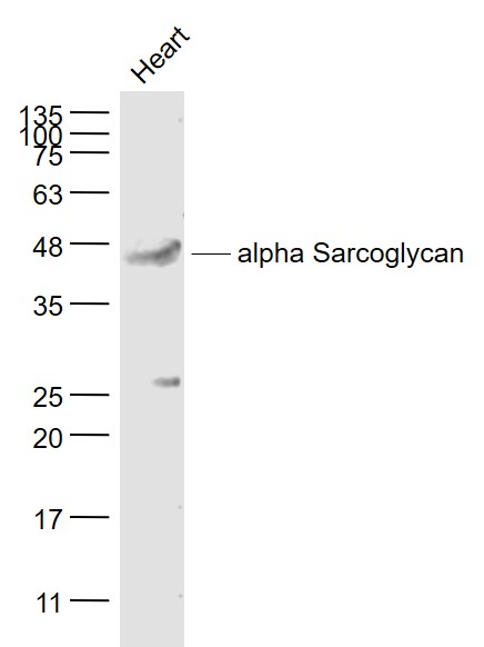 alpha Sarcoglycan Rabbit pAb (一抗) | Bioss
