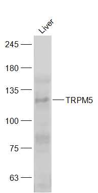 TRPM5 Rabbit pAb (一抗) | Bioss
