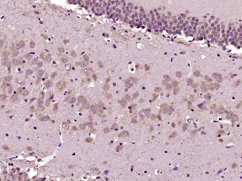 FBXO21 Rabbit pAb (一抗) | Bioss