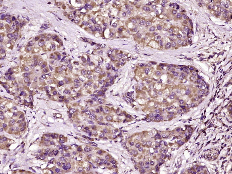 F-box蛋白21抗体-bs-9121R