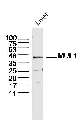 MUL1 Rabbit pAb (一抗) | Bioss