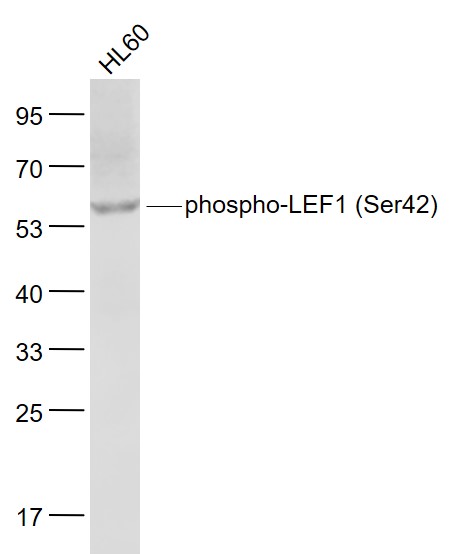 磷酸化淋巴增强因子-1抗体-bs-9842R