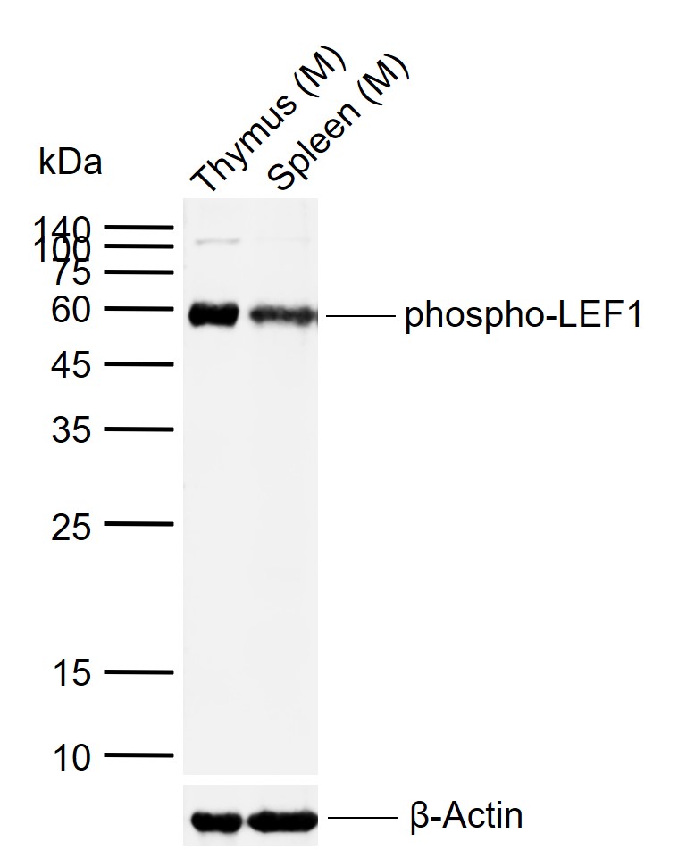 磷酸化淋巴增强因子-1抗体-bs-9842R