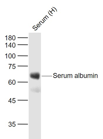 Human Serum albumin Mouse mAb, Loading Control (一抗) - WB | Bioss
