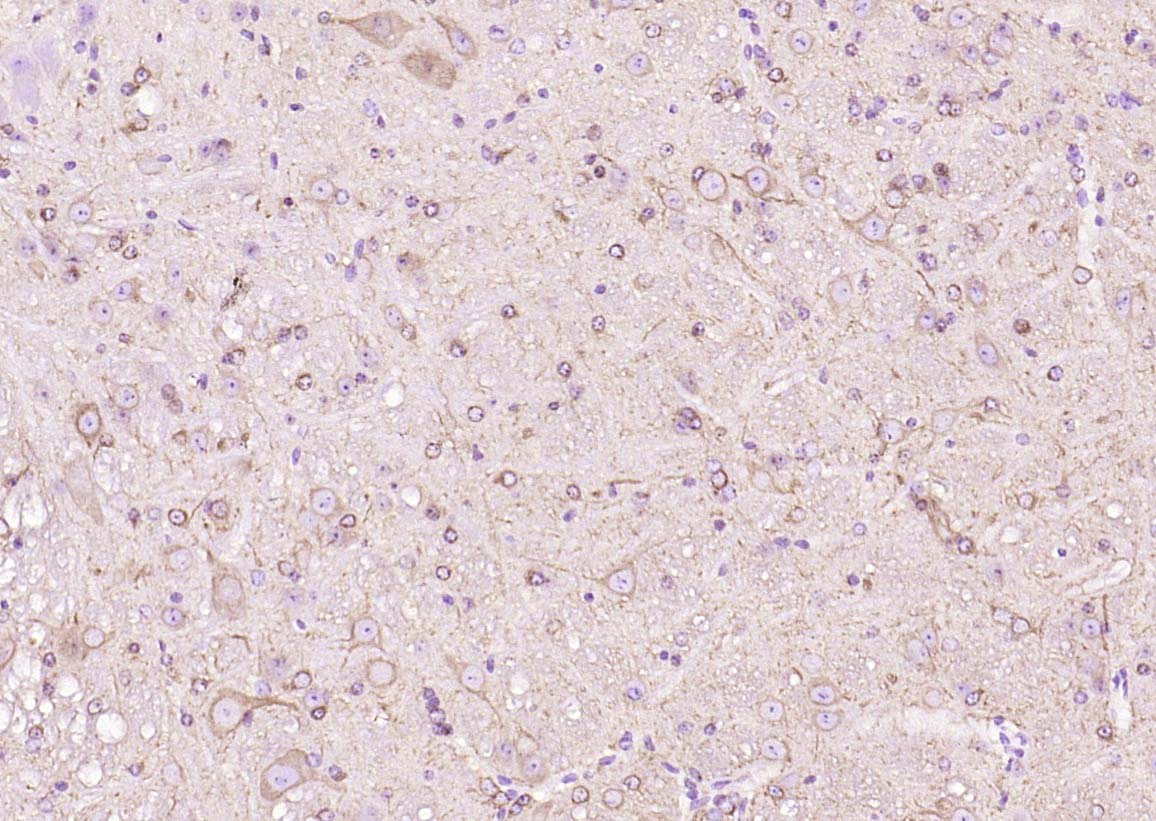 微管蛋白β tubulin/Tubulin β（内参）单克隆抗体-bsm-33034M