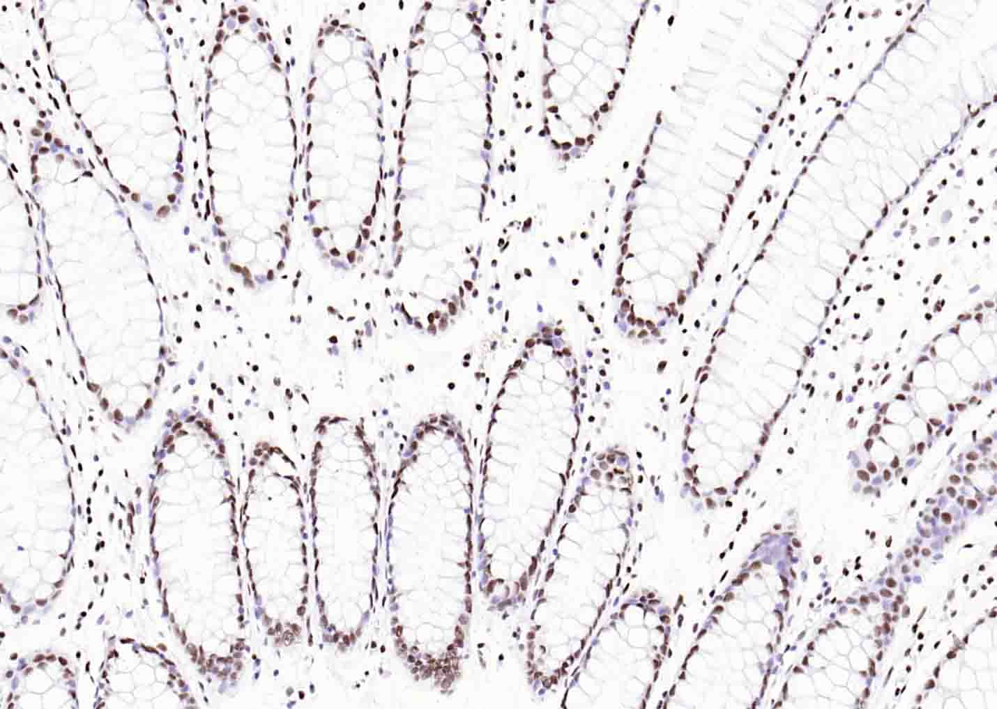 组蛋白H3(核内参)单克隆抗体-bsm-33042M