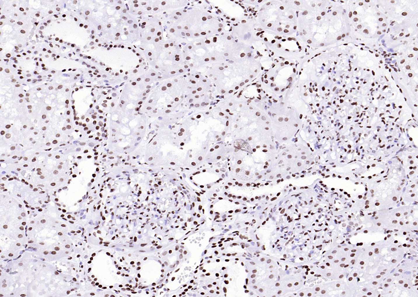 组蛋白H3(核内参)单克隆抗体-bsm-33042M