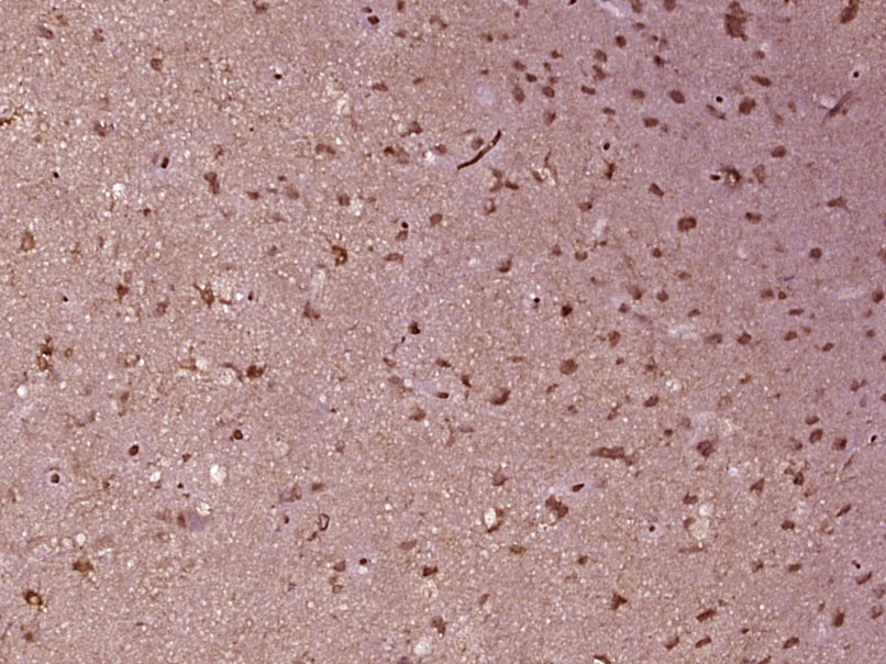 表皮生长因子受体单克隆抗体-bsm-33050M