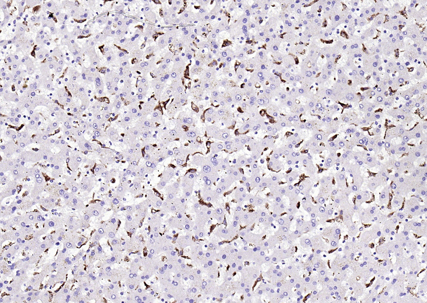 CD68 Mouse mAb (一抗) - IHC-P,IHC-F,IF | Bioss