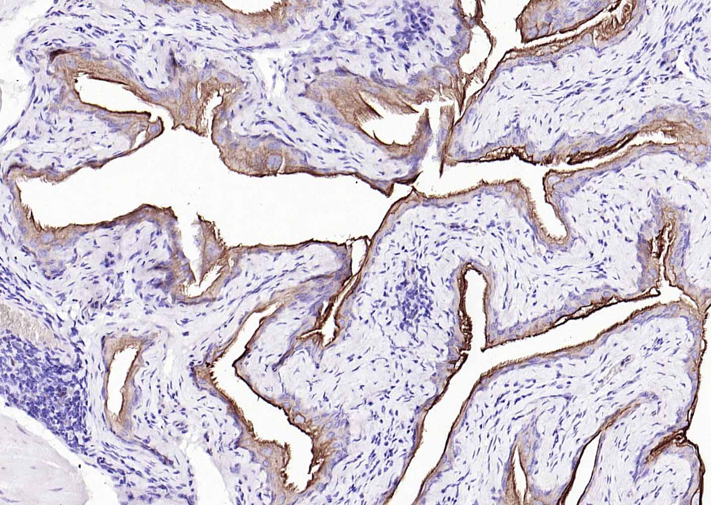 细胞角蛋白7单克隆抗体-bsm-33060M