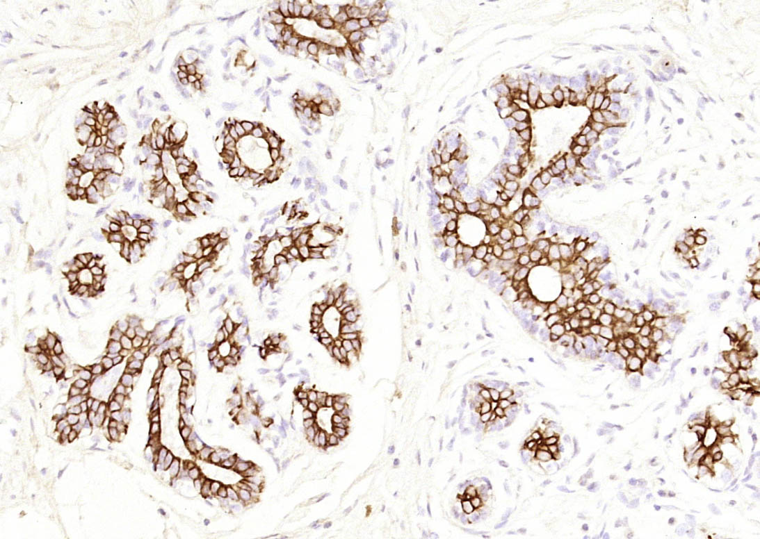 细胞角蛋白7单克隆抗体-bsm-33060M