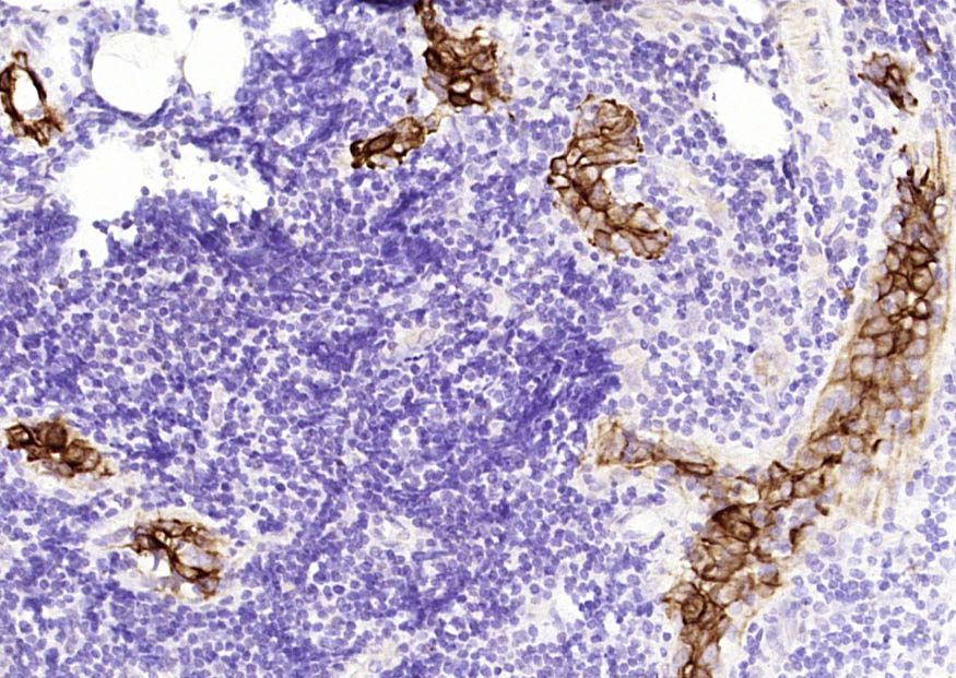 细胞角蛋白7单克隆抗体-bsm-33060M