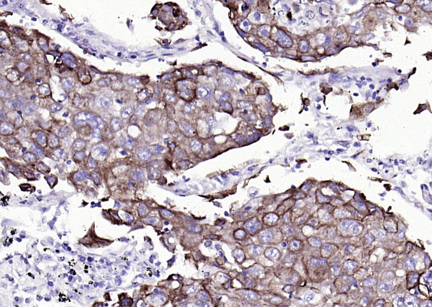 细胞角蛋白7单克隆抗体-bsm-33060M