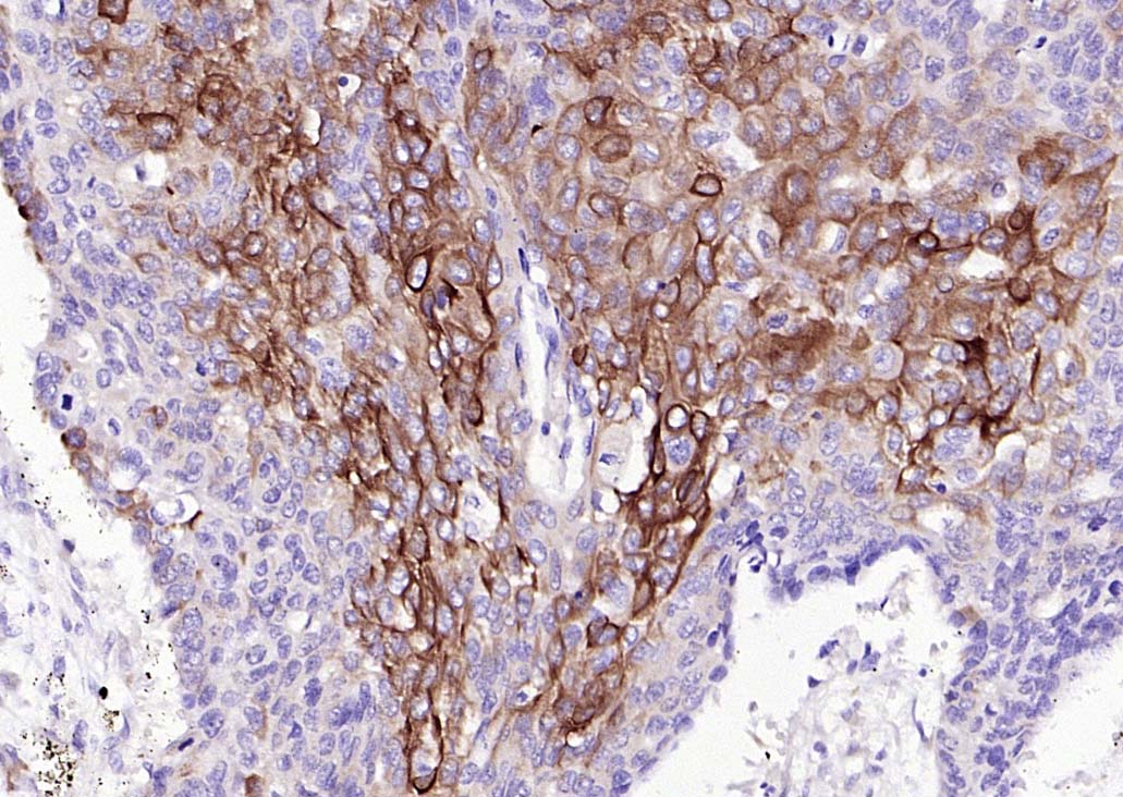 细胞角蛋白7单克隆抗体-bsm-33060M