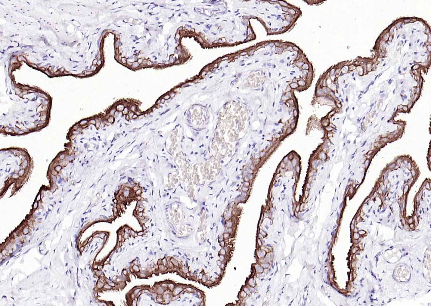 细胞角蛋白7单克隆抗体-bsm-33060M