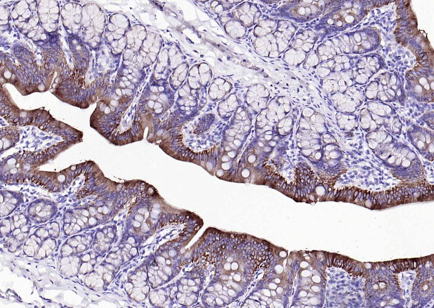 细胞角蛋白7单克隆抗体-bsm-33060M