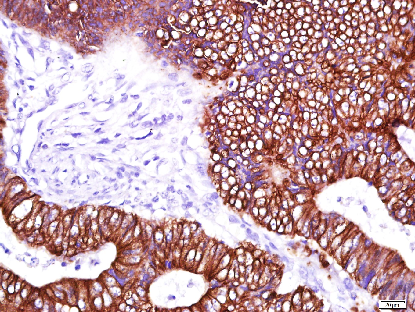 Cytokeratin 8 Mouse mAb (一抗) - IHC-P,IHC-F,IF,Flow-Cyt | Bioss