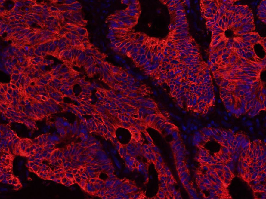 细胞角蛋白8单克隆抗体-bsm-33061M