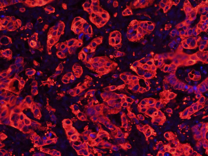 细胞角蛋白8单克隆抗体-bsm-33061M