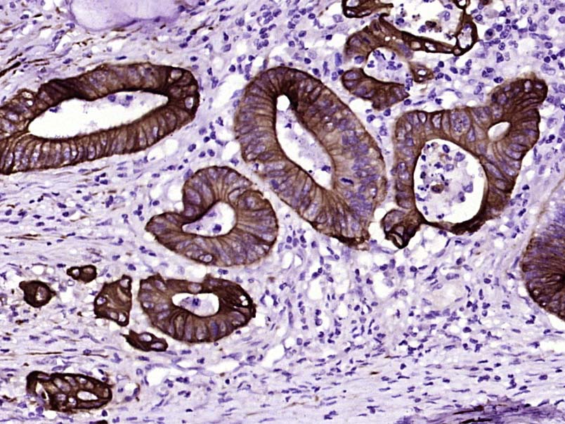 细胞角蛋白8单克隆抗体-bsm-33061M
