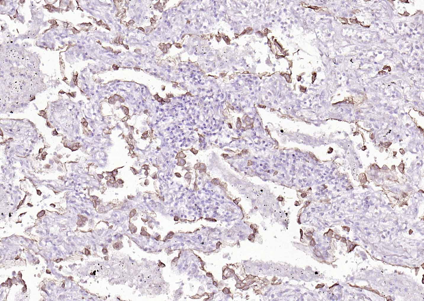 细胞角蛋白8单克隆抗体-bsm-33061M