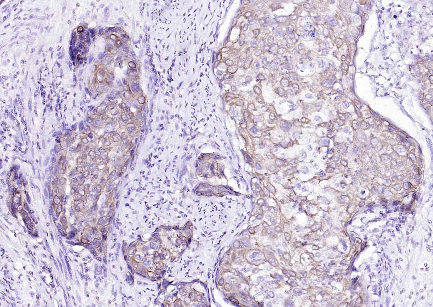 细胞角蛋白8单克隆抗体-bsm-33061M