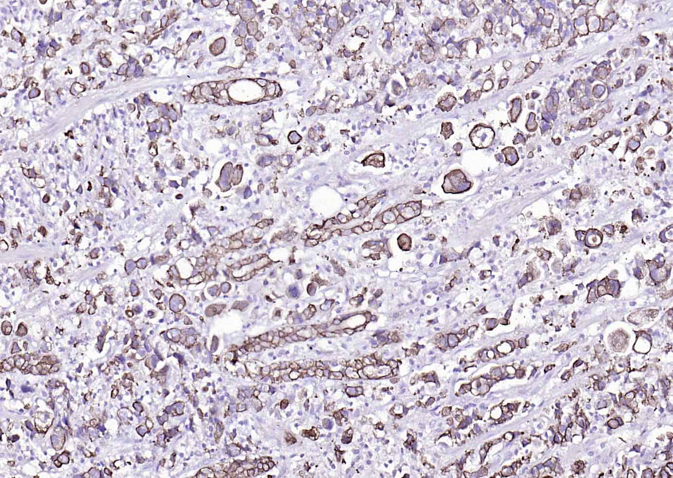 细胞角蛋白8单克隆抗体-bsm-33061M