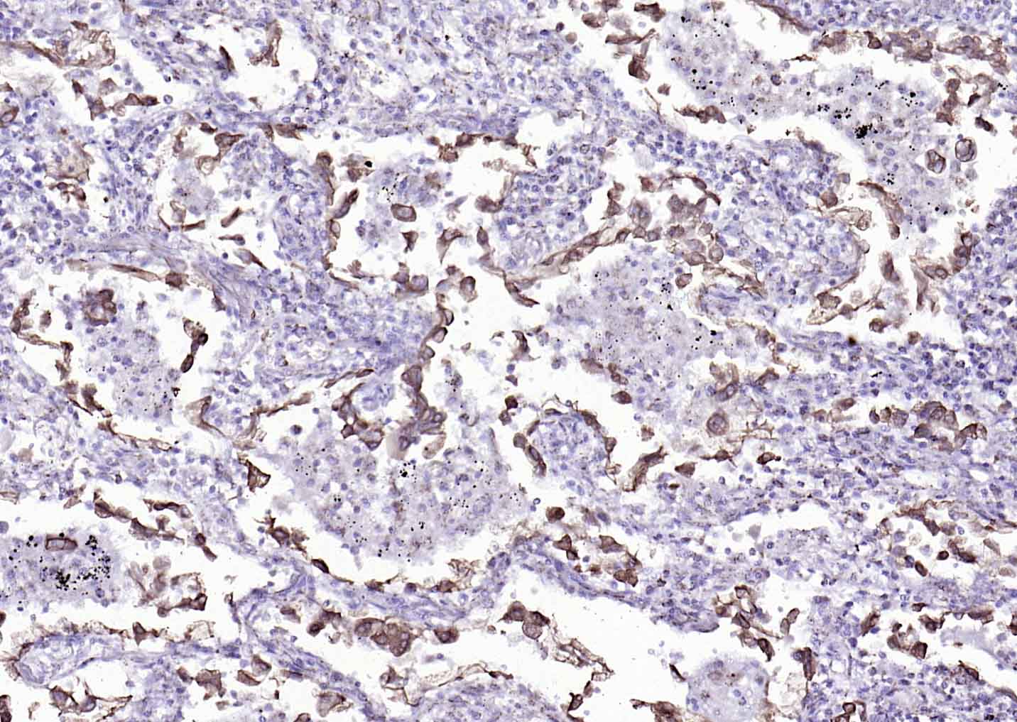 细胞角蛋白8单克隆抗体-bsm-33061M