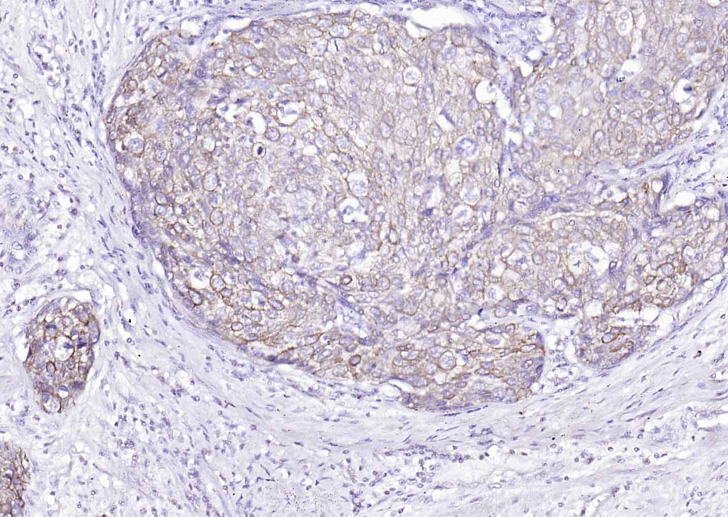 细胞角蛋白8单克隆抗体-bsm-33061M