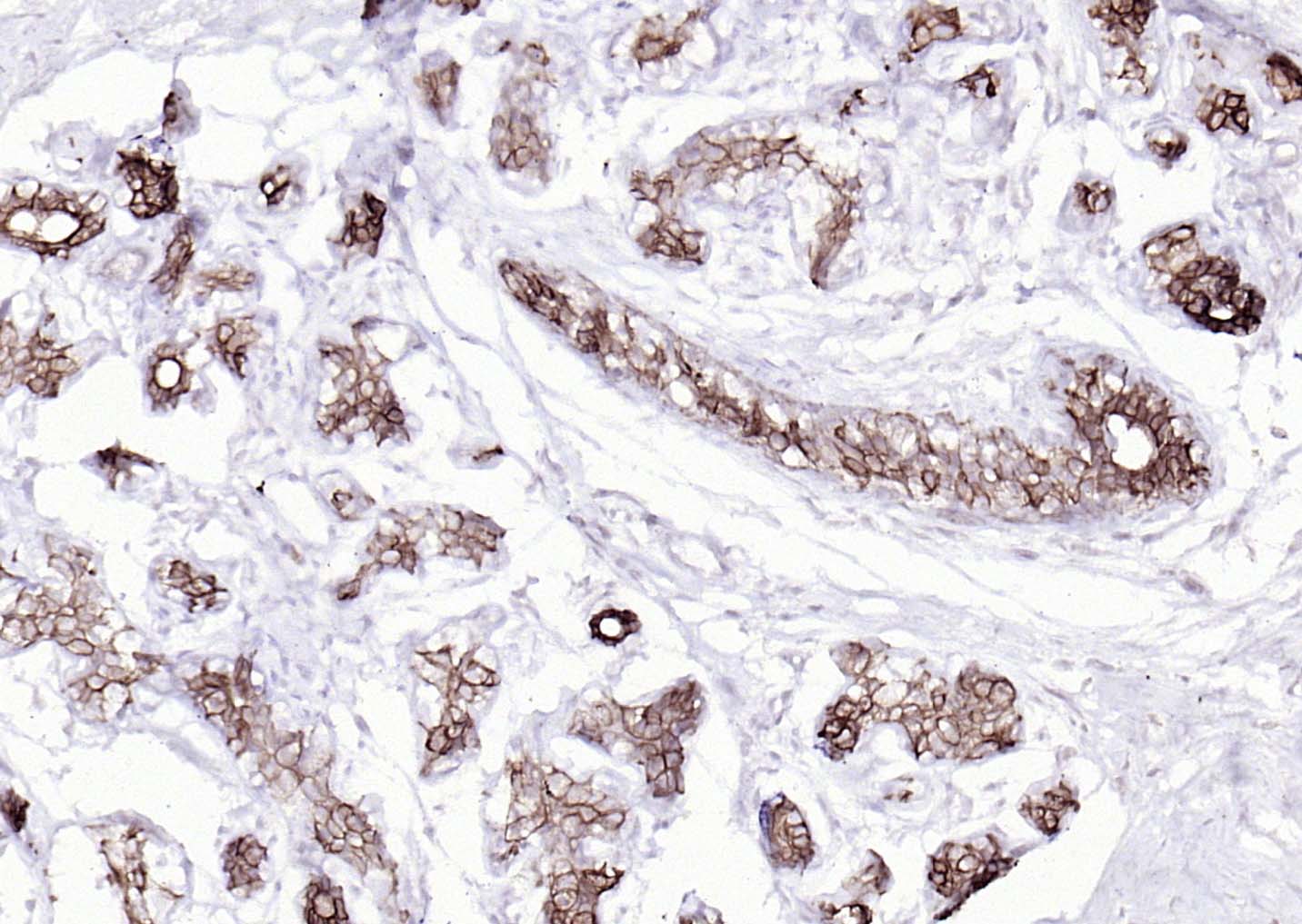 细胞角蛋白8单克隆抗体-bsm-33061M