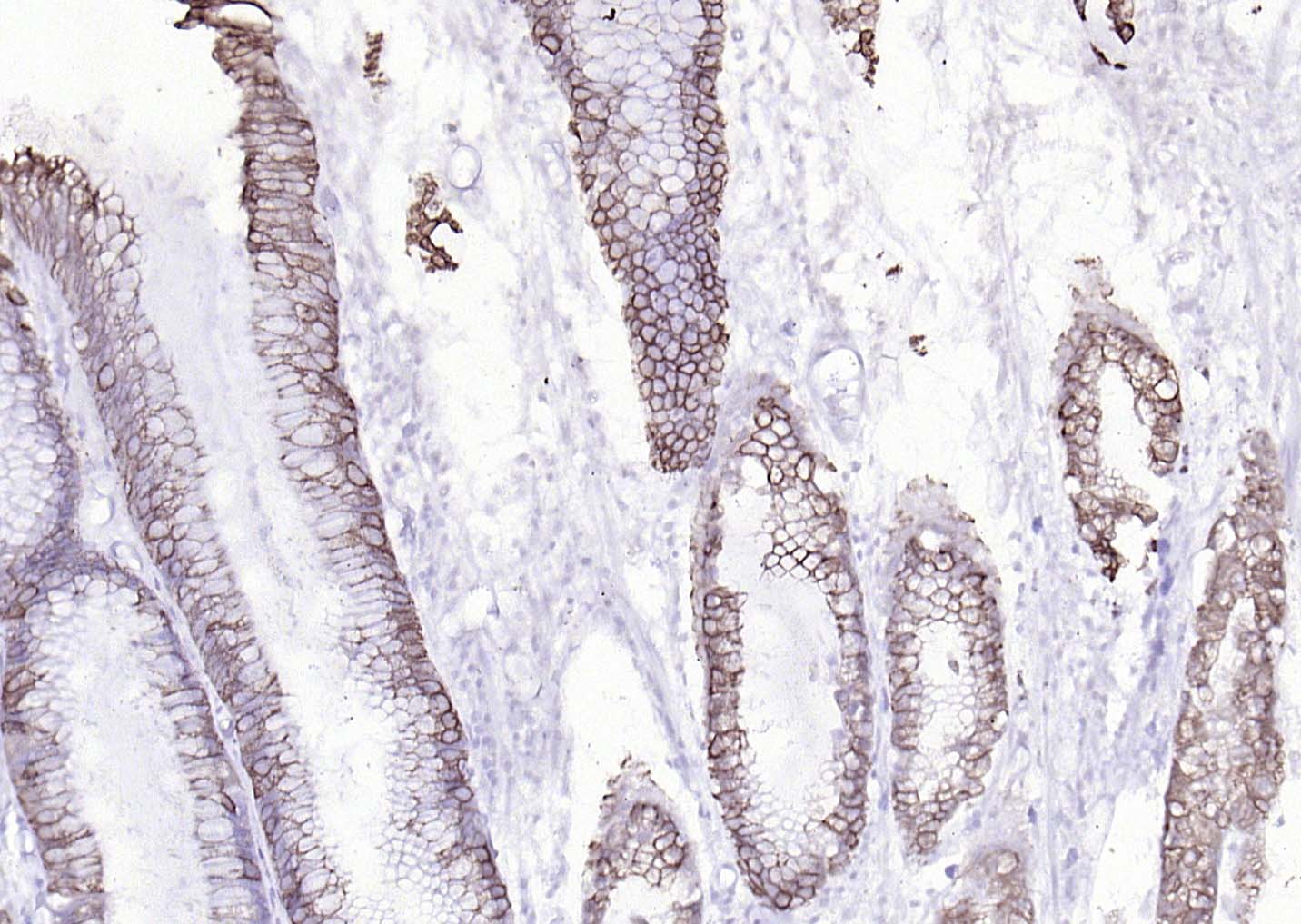 细胞角蛋白8单克隆抗体-bsm-33061M