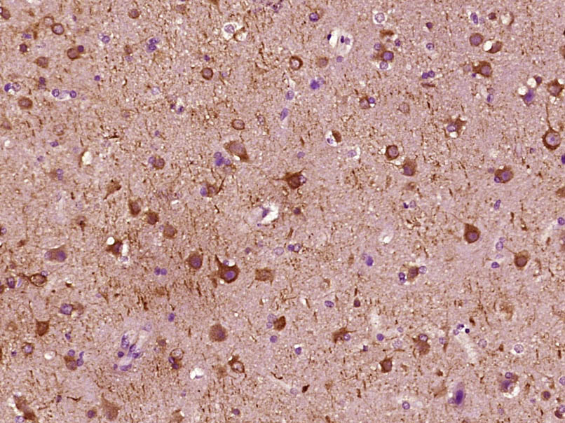 MAP2 Mouse mAb (一抗) | Bioss