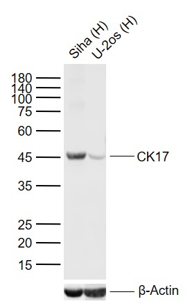 CK17 Mouse mAb (一抗) - WB,IHC-P,IHC-F,IF | Bioss
