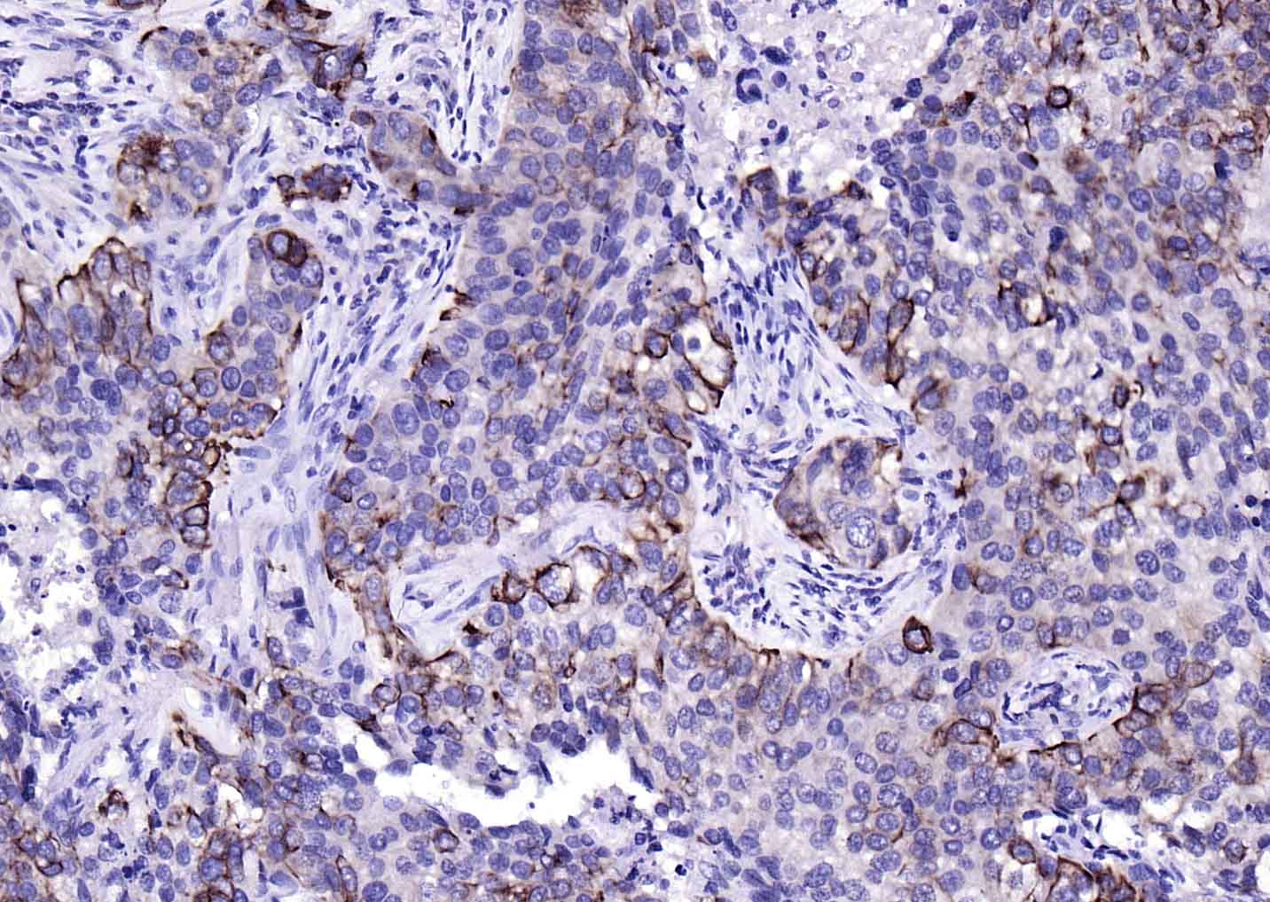 细胞角蛋白17单克隆抗体-bsm-33087M