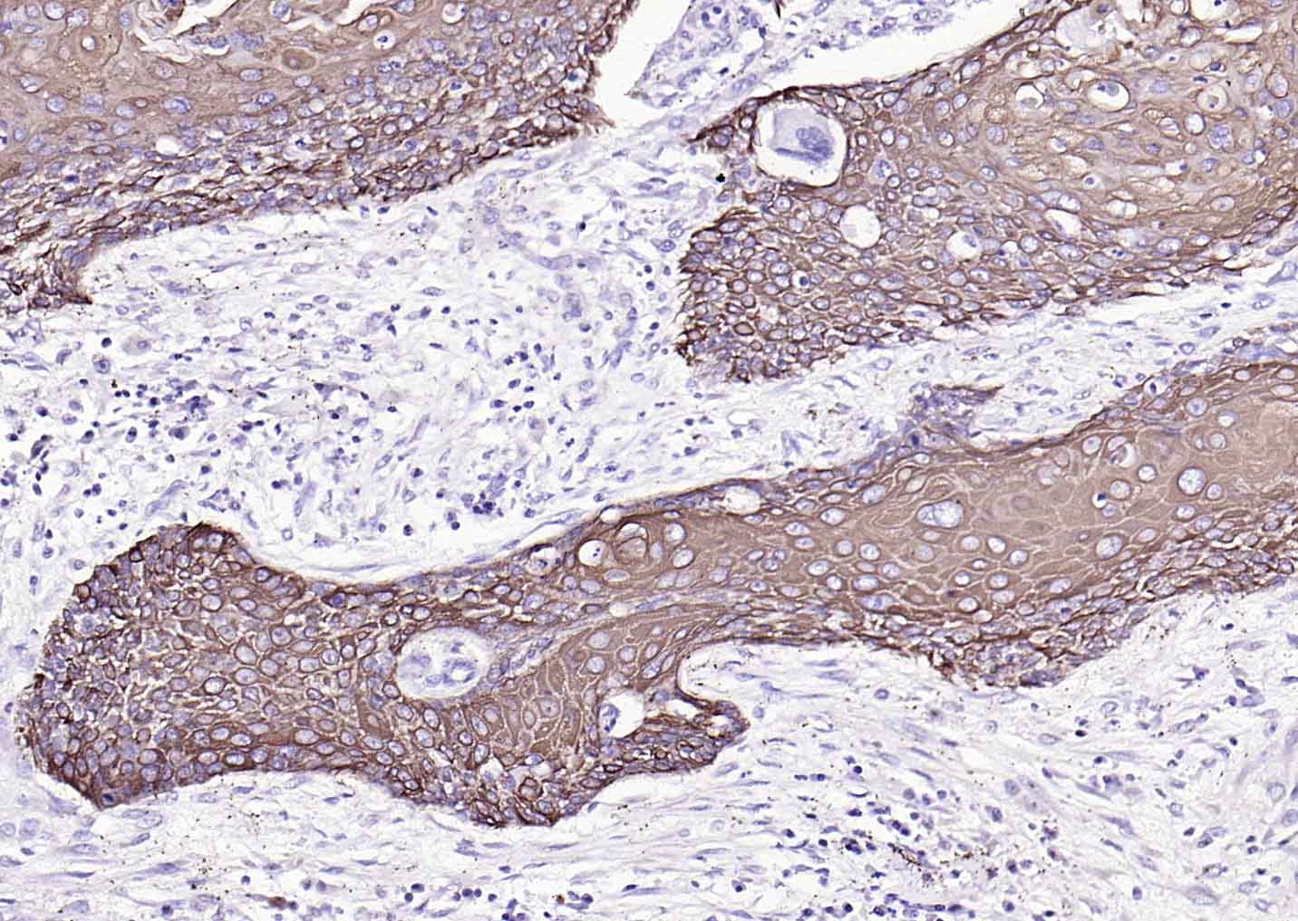 细胞角蛋白17单克隆抗体-bsm-33087M