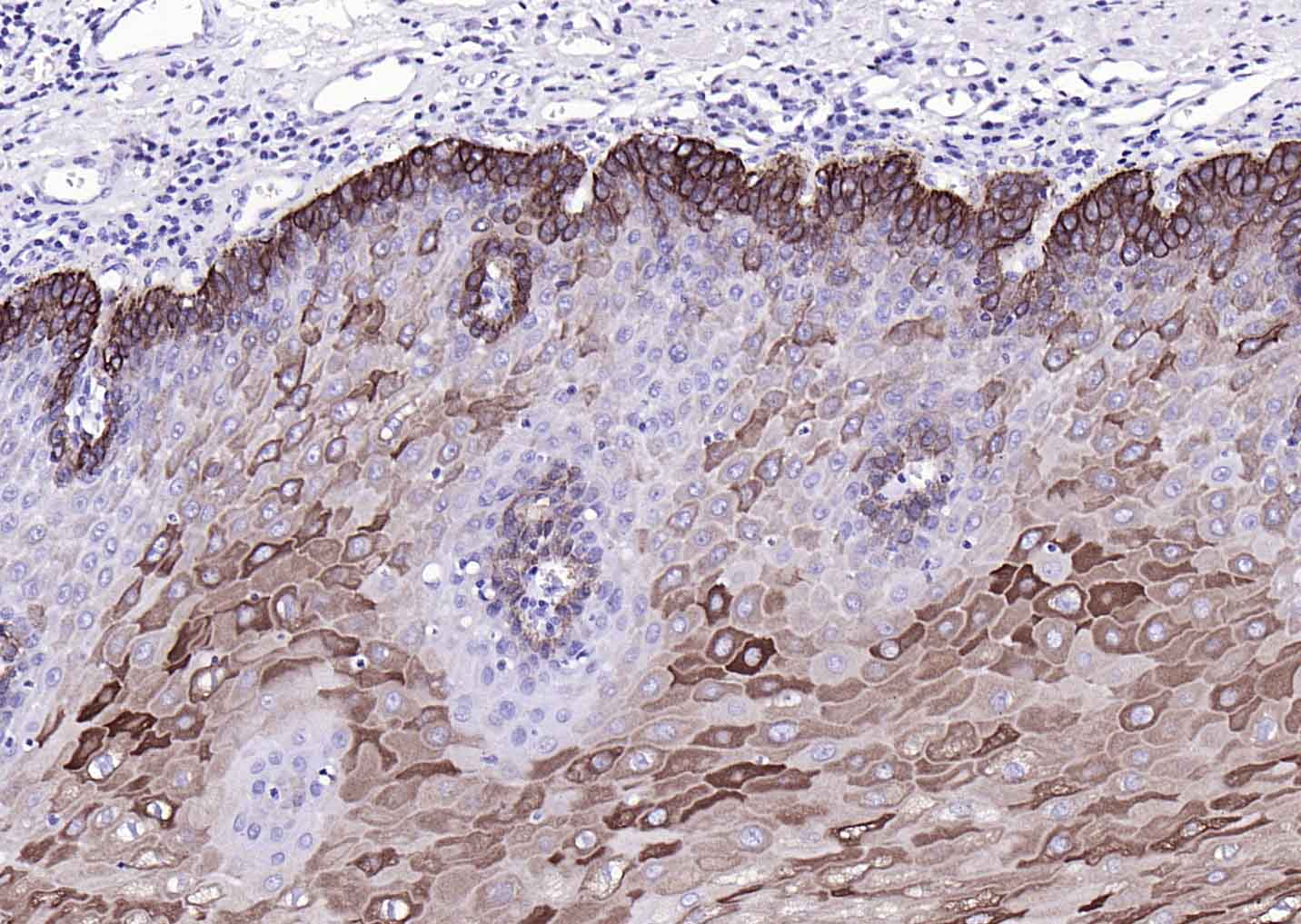 细胞角蛋白17单克隆抗体-bsm-33087M