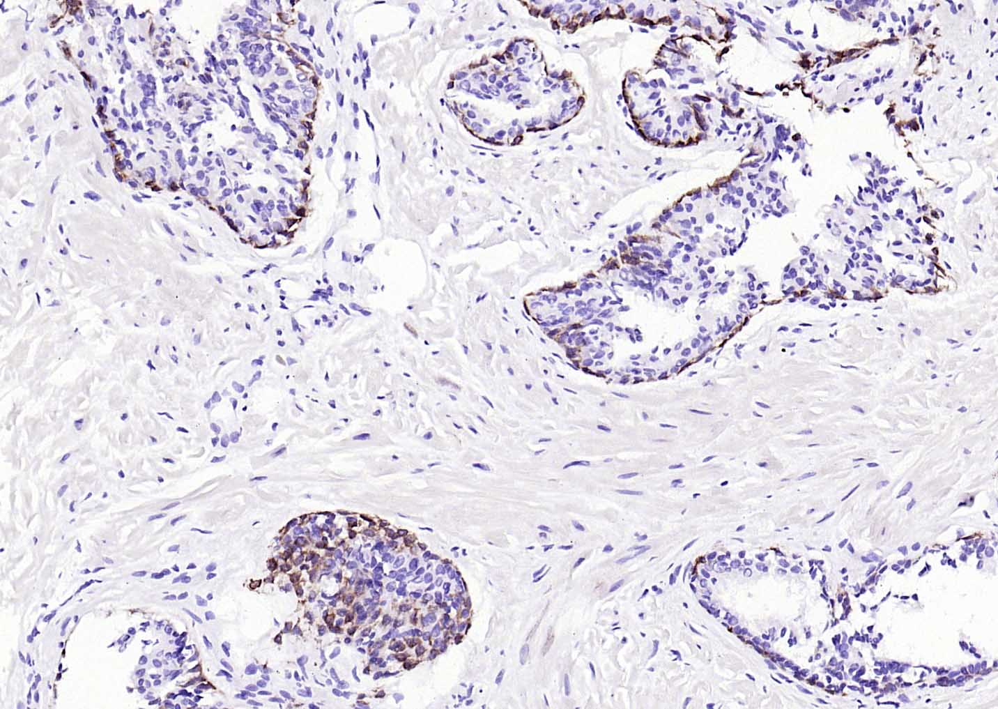 细胞角蛋白17单克隆抗体-bsm-33087M