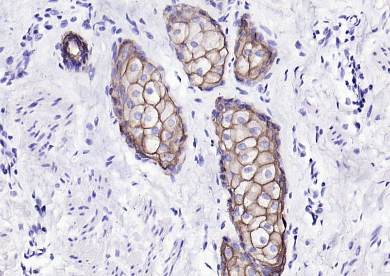 细胞角蛋白17单克隆抗体-bsm-33087M