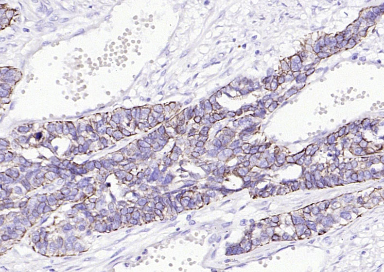 细胞角蛋白17单克隆抗体-bsm-33087M