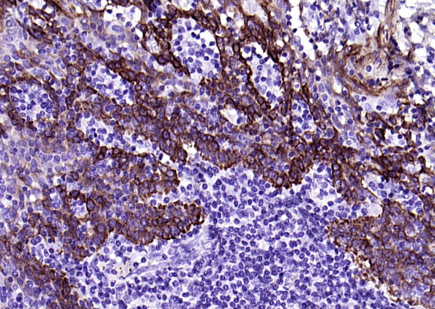 细胞角蛋白17单克隆抗体-bsm-33087M