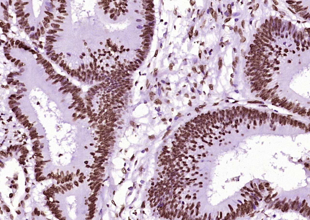 甲基化组蛋白H3(Tri methyl K79)单克隆抗体-bsm-33098M