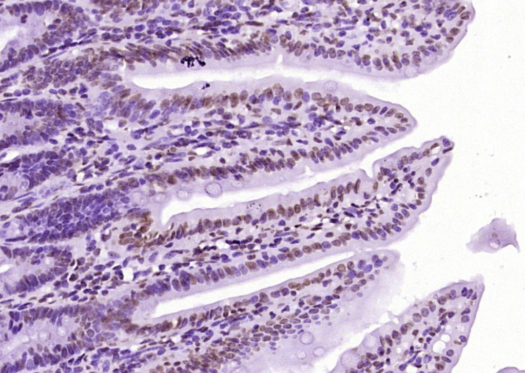 甲基化组蛋白H3(Tri methyl K79)单克隆抗体-bsm-33098M