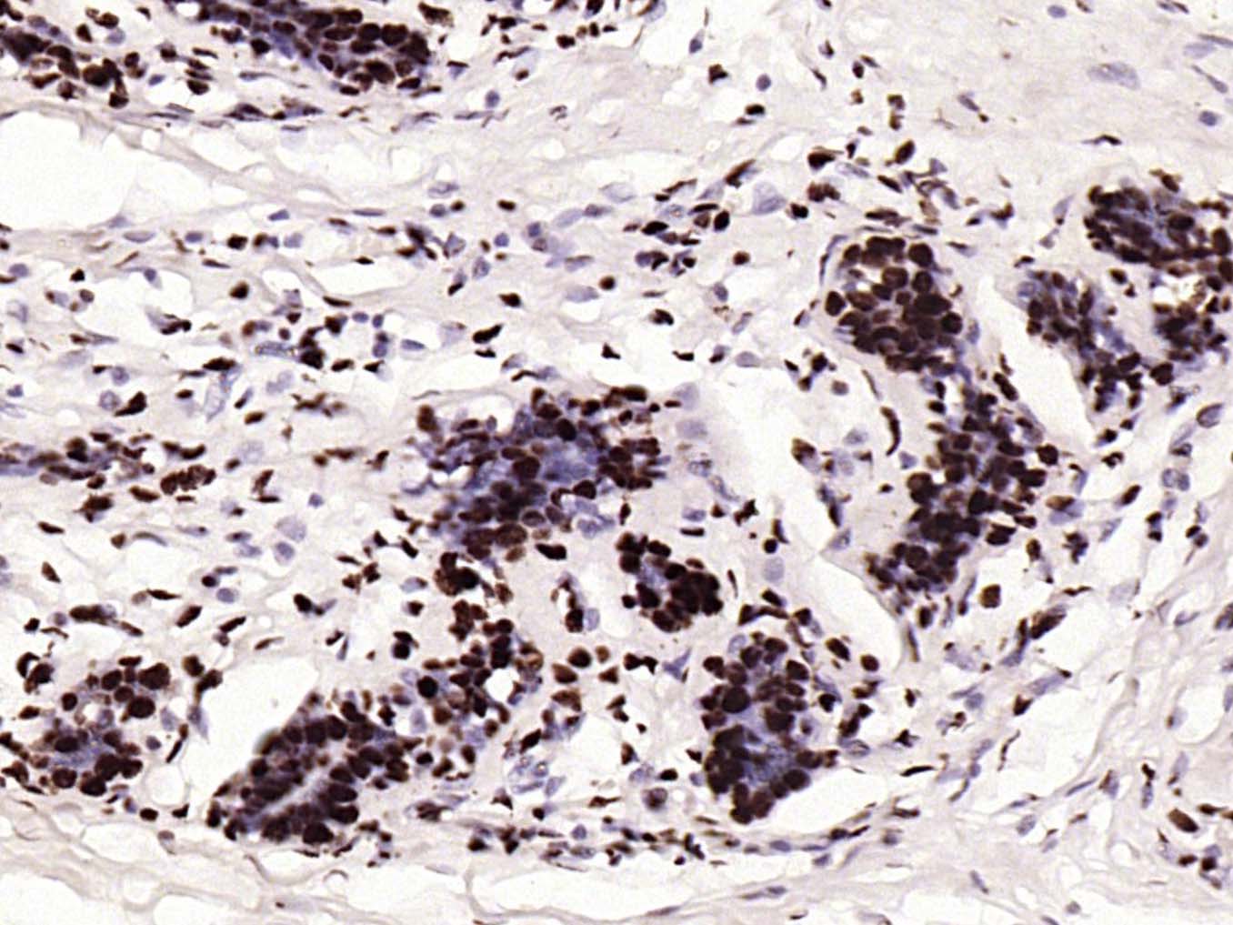 甲基化组蛋白H3(Tri methyl K79)单克隆抗体-bsm-33098M