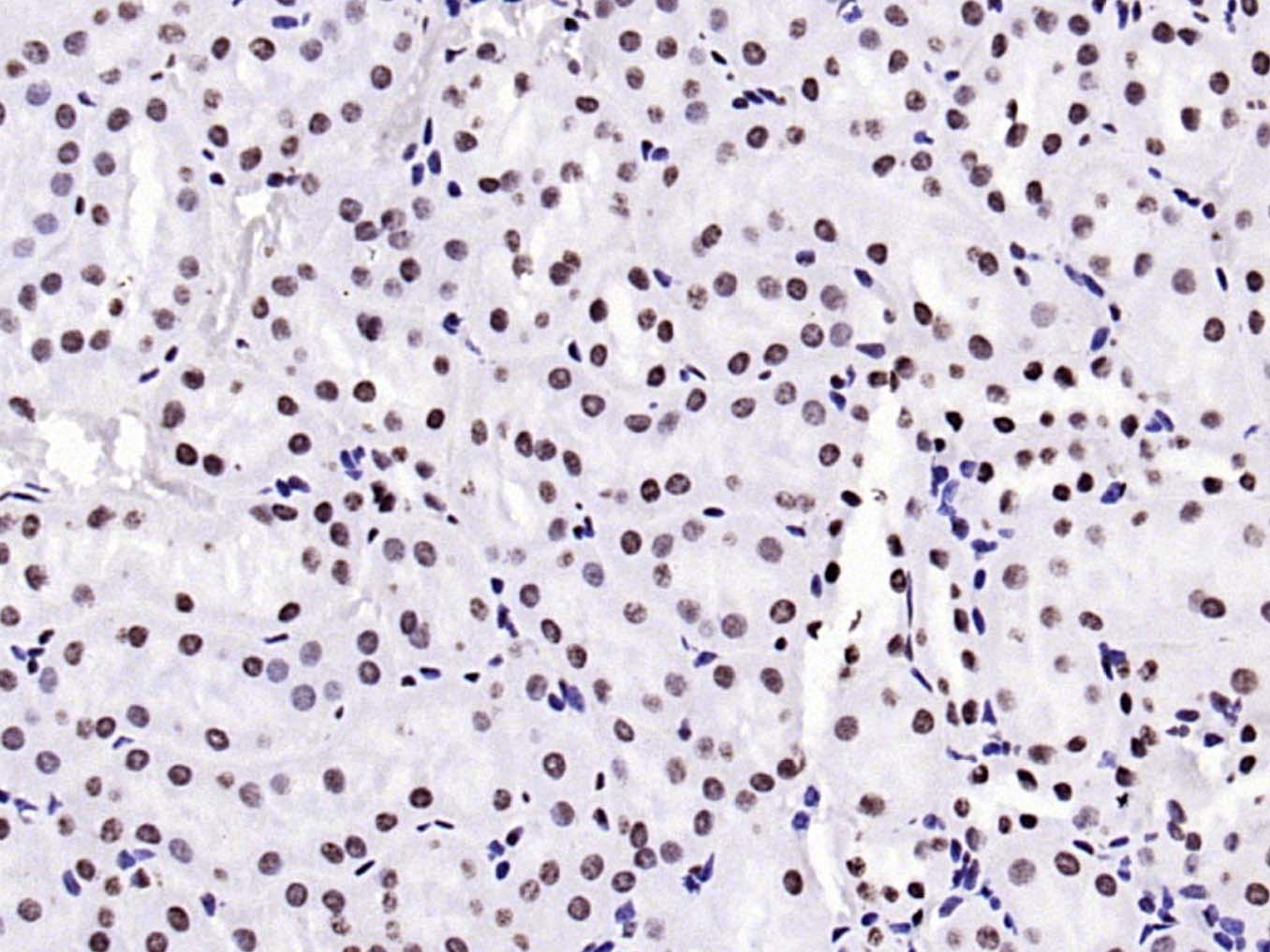 甲基化组蛋白H3(Tri methyl K79)单克隆抗体-bsm-33098M