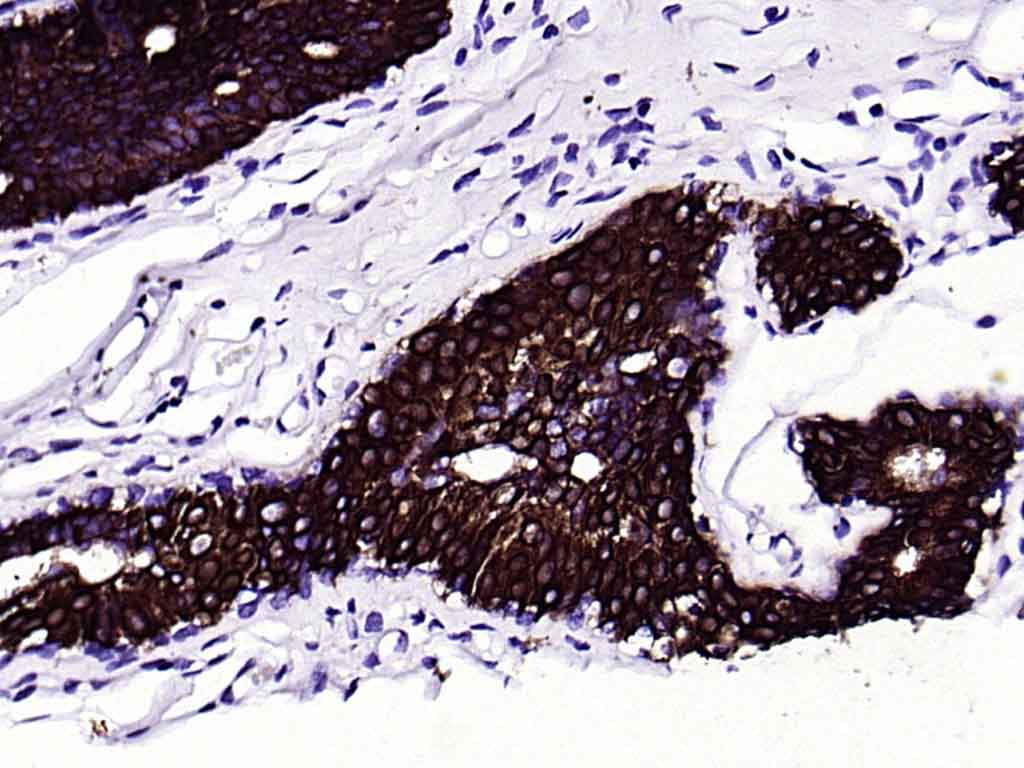 细胞角蛋白18单克隆抗体-bsm-33103M