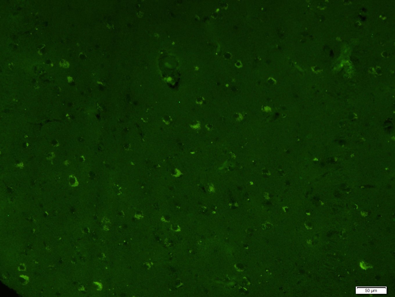 表皮生长因子受体单克隆抗体-bsm-33140M