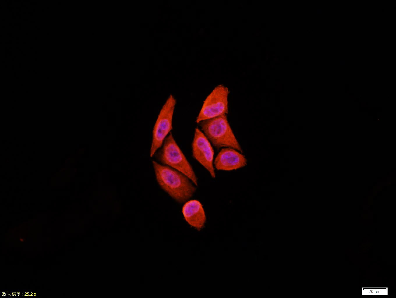 表皮生长因子受体单克隆抗体-bsm-33140M